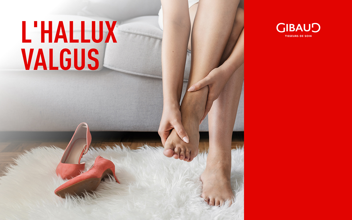 hallus-valgus